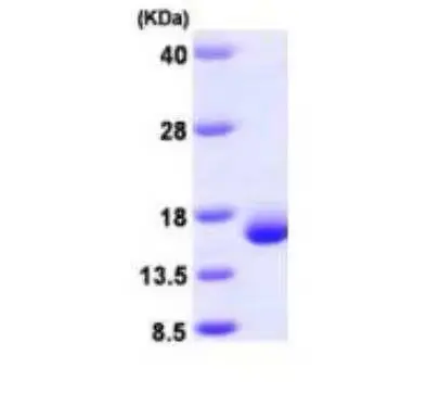 Recombinant Human Galectin 2, His Tag -100 ug