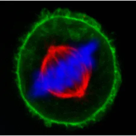 [GEN-BIO-27044] Uracil DNA Glycosylase (UDG)